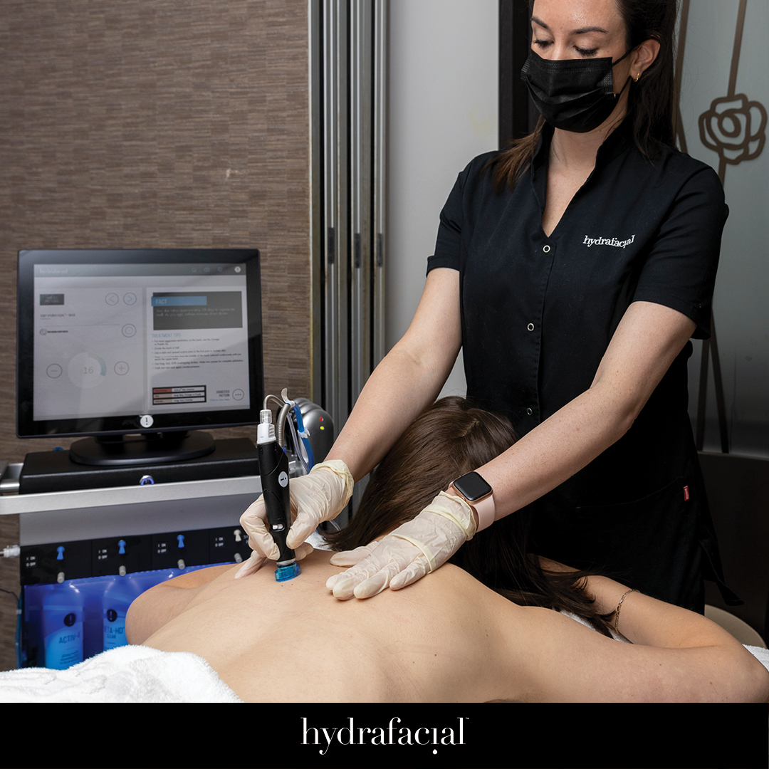 Hydrafacial