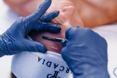 Dermaplaning Zertifizierung 20.10.2025