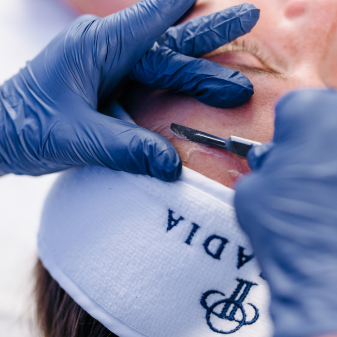 Dermaplaning Zertifizierung 28.04.2025
