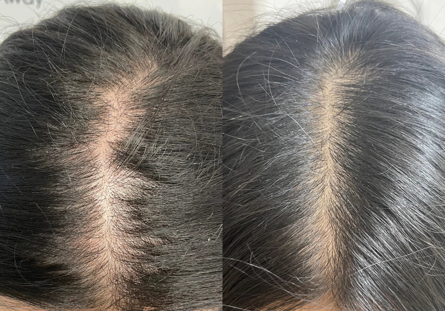 Dünner werdendes Haar