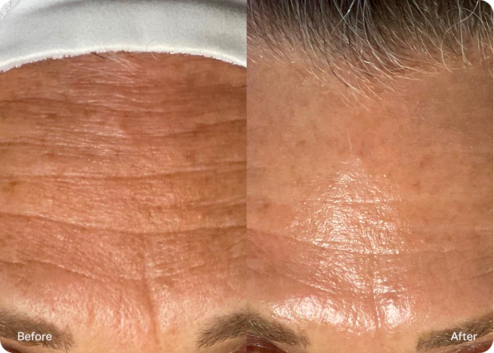 Anzeichen des Alterns